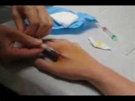 rfid chip procedure obama care 2014|Must Citizens Who Want to Receive Government Benefits Agree .